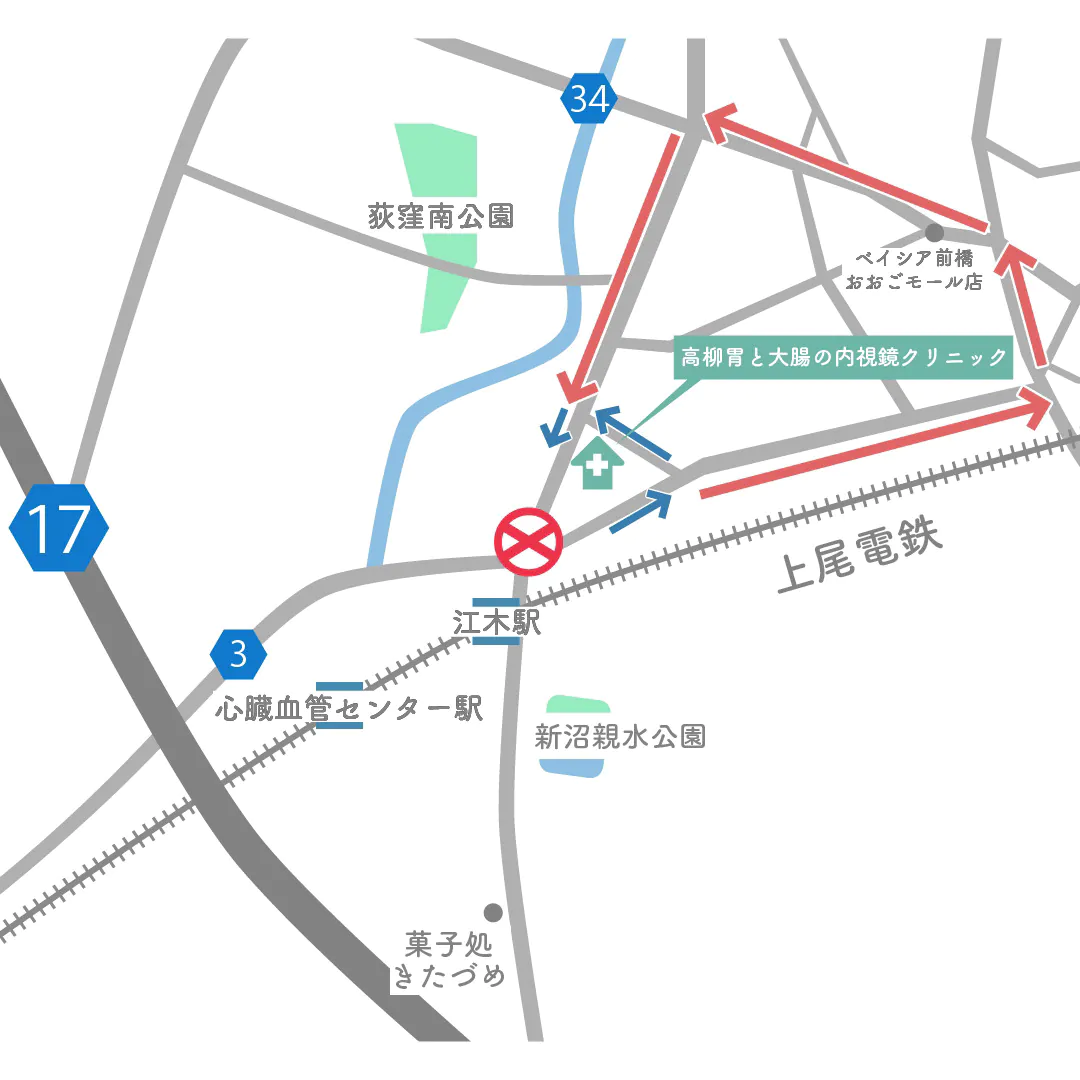 道路工事について